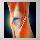 Zoek naar knie posters Medisch