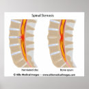 Zoek naar rugpijn posters Anatomie