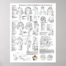 Zoek naar hoofdpijn posters Acupuncturist