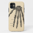 Zoek naar medisch iphone hoesjes Anatomie