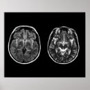 Zoek naar anatomie hersenen posters Hoofd