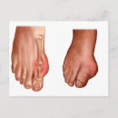 Zoek naar voet anatomie posters Transparant