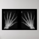 Zoek naar röntgen posters Radiology