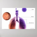 Zoek naar longen posters Deel