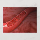 Zoek naar batterij briefkaarten Horizontaal