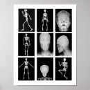 Zoek naar menselijke huid posters Anatomie