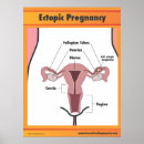 Zoek naar zwangerschap posters Gezondheid