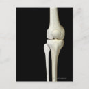 Zoek naar knie briefkaarten Medisch