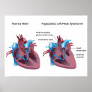 Zoek naar hart anatomie posters Menselijk