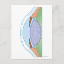 Zoek naar chirurgie briefkaarten Medisch