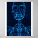 Zoek naar röntgen posters Skelet