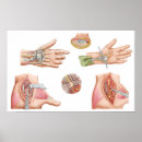 Zoek naar slagaders posters Detail