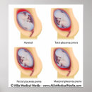 Zoek naar gynaecologie posters Anatomie