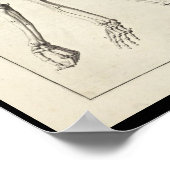 1691 Kunstmatige anatomie Botten Kunst afdrukken Poster (Hoek)