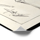 1691 Kunstmatige anatomie Botten Kunst afdrukken Poster (Hoek)