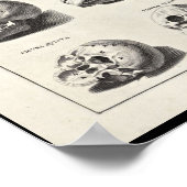 1691 Kunstmatige anatomie schedel afdrukken Poster (Hoek)