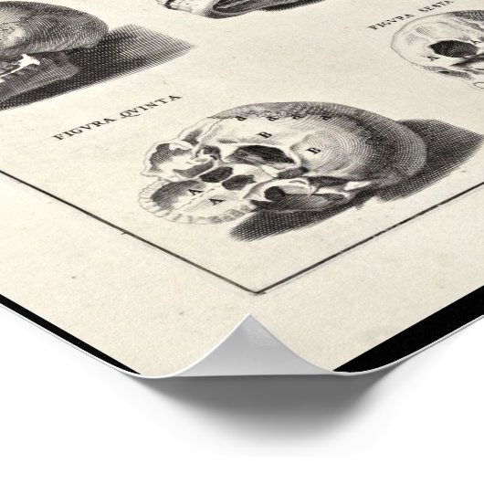1691 Kunstmatige anatomie schedel afdrukken Poster (Hoek)