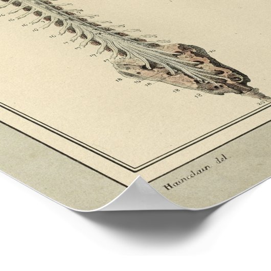 1831 Anatomie van het braindrain van het Spinnets Poster (Hoek)