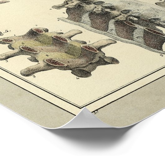  1831 Spinale kolomanatomie Afdrukken Poster (Hoek)