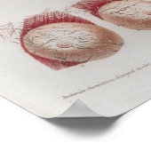 1833  zenuwkop Poster anatomie (Hoek)