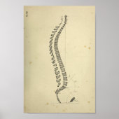  1843 Anatomie van de Humaan Spinale Kolom Poster (Voorkant)