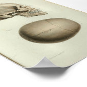 1844  anatomie Afdrukken Menselijke schedel Poster (Hoek)