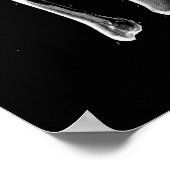 1844 anatomie Afdruktibia Fibula Poster (Hoek)