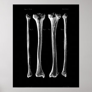 1844 anatomie Afdruktibia Fibula Poster