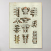 1844  anatomie printruggenwervel poster (Voorkant)