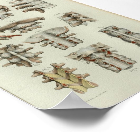 1844  anatomie printruggenwervel poster (Hoek)