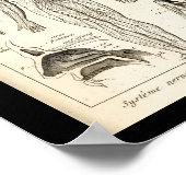  1844 Menselijke zenders Anatomy Print (Hoek)