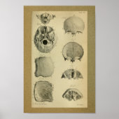1850  anatomie Afdrukschedel Poster (Voorkant)