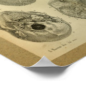 1850 anatomie Afdrukschedel Poster (Hoek)