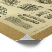 1850  anatomie Afdrukvoetspieren Poster (Hoek)