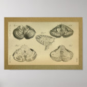 1850  anatomie Print Brain Cerebellum (Voorkant)