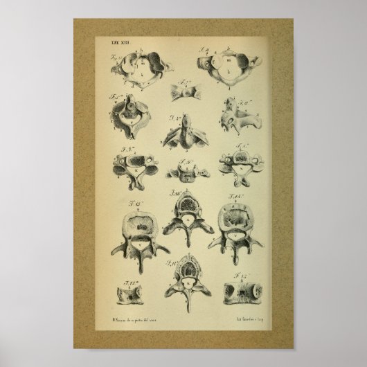 1850  anatomie printruggenwervel poster (Voorkant)