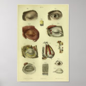 1866 Anatomie van het menselijk oog afdrukken Poster (Voorkant)