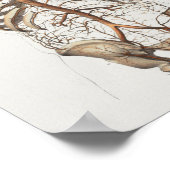 1867 Aorta Skeleton  Anatomy Print (Hoek)