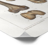 1867 Been Femur Botten Anatomie Afdrukken Poster (Hoek)