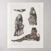 1867 Foot Botten Anatomy Print (Voorkant)
