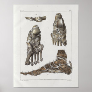 1867 Foot Botten  Anatomy Print