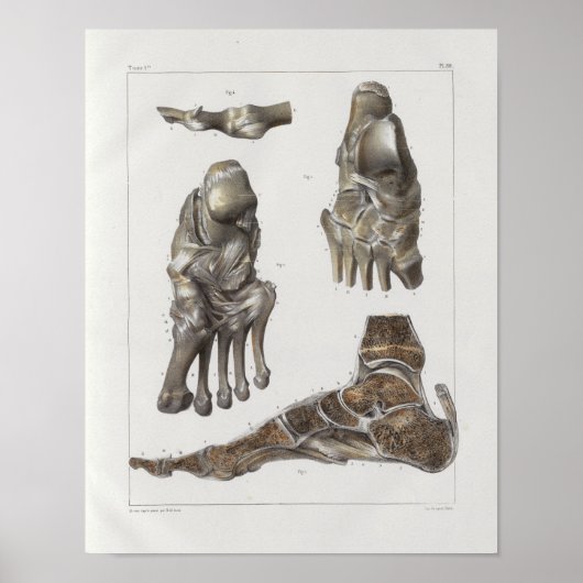 1867 Foot Botten Anatomy Print (Voorkant)