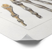 1867 Hand Botten Anatomy Print (Hoek)