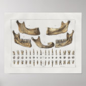1867 Jaw Teeth Dental  Anatomy Print (Voorkant)