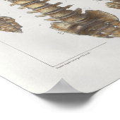 1867 Spinale kolom  anatomie Medische druk Poster (Hoek)