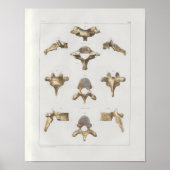 1867 Spinale vertebrae  Anatomie Afdrukken Poster (Voorkant)