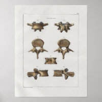 1867 Spinale wervels Botten Anatomie Afdrukken