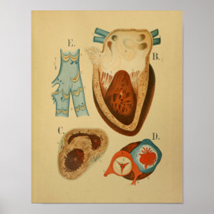 1879  anatomie Afdrukken Menselijk hart Intern Poster