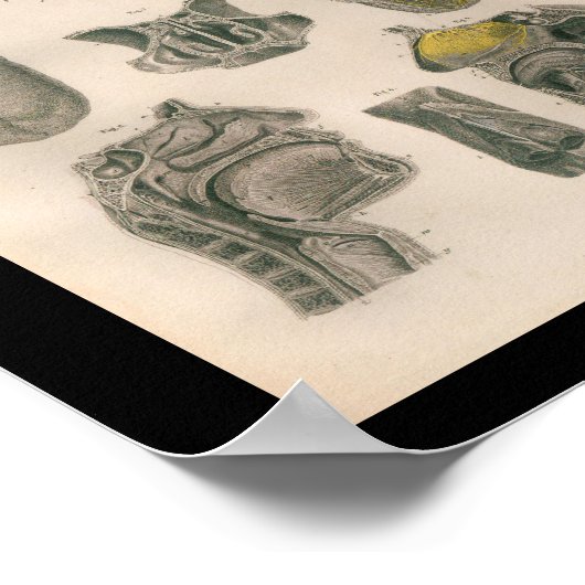 1879  Bock Anatomy Print Nose Throat (Hoek)