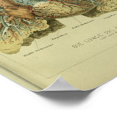 1886 humane Lungs-anatomie afdrukken Poster (Hoek)